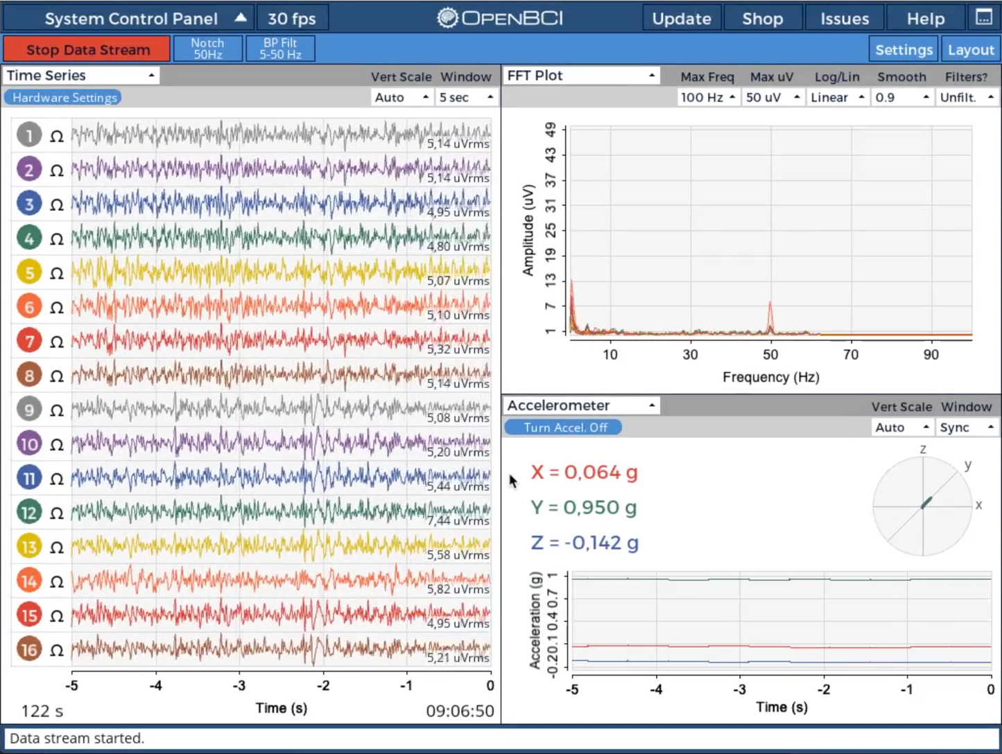 Open-cEEGrid Around-the-Ear EEG Bundle