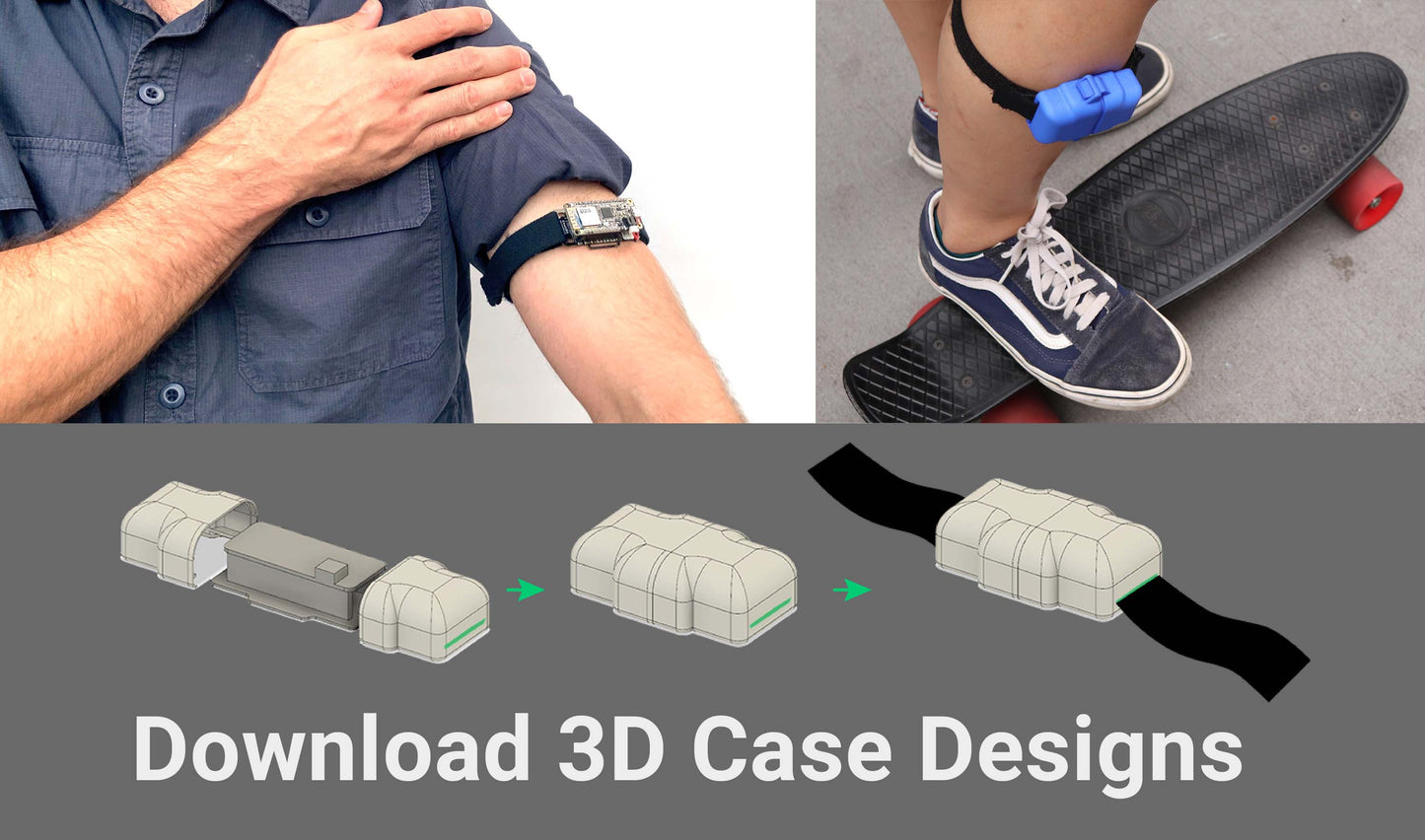 All-in-One EmotiBit Bundle