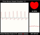 Sensor de pulso (monitor de frequência cardíaca)